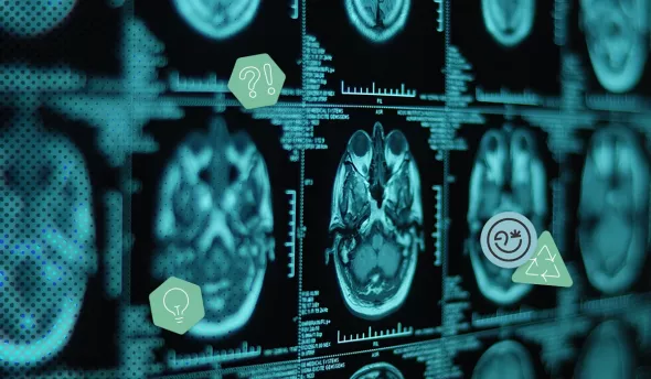 Images d'IRM cérébrales affichées sur un écran médical